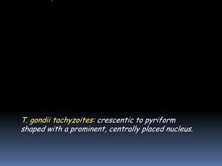 T. gondii tachyzoites: crescentic to pyriform
shaped with a prominent, centrally placed nucleus.
 