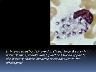 L. tropica amastigotes: ovoid in shape; large & eccentric
nucleus; small, rodlike kinetoplast positioned opposite
the nucleus; rodlike axoneme perpendicular to the
kinetoplast
 