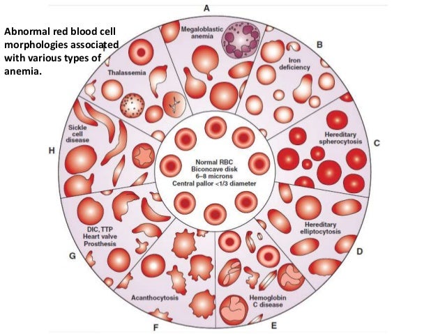 blood pathophysiology abnormal rbc morphology
