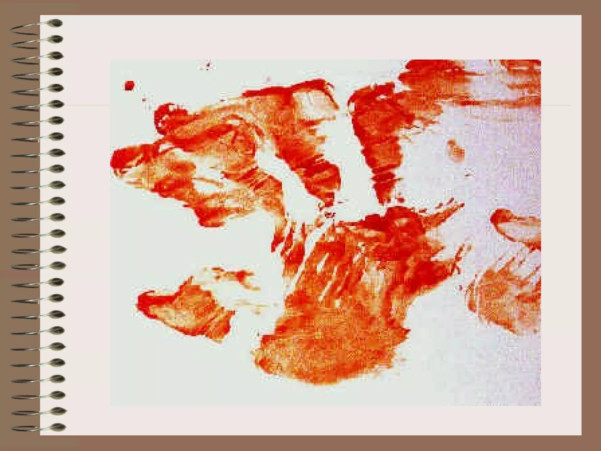 Poolblood Pattern Blood pattern analysis | PPT