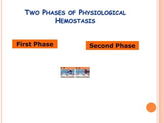 TWO PHASES OF PHYSIOLOGICAL
         HEMOSTASIS


First Phase        Second Phase
 