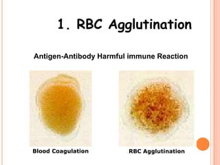 1. RBC Agglutination

Antigen-Antibody Harmful immune Reaction




Blood Coagulation       RBC Agglutination
 