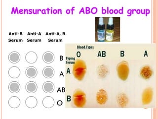 Mensuration of ABO blood group

Anti-B   Anti-A   Anti-A, B
Serum    Serum     Serum
 