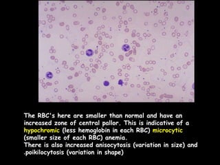 Clinical aspects of Blood Physiology.ppt