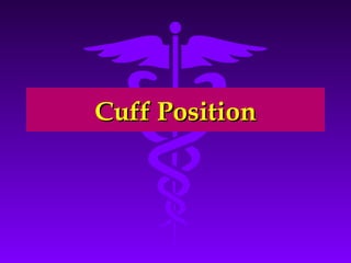 CCuuffff PPoossiittiioonn 
 