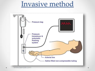 Invasive method
www.laerdal.com
 