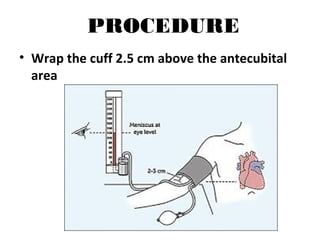 PROCEDURE
• Wrap the cuff 2.5 cm above the antecubital
area
 