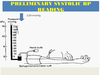 PRELIMINARY SYSTOLIC BP
READING
 