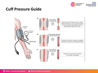 Cuff Pressure Guide
 