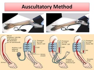 Blood pressure | PPTX