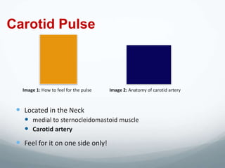 Carotid Pulse



   Image 1: How to feel for the pulse   Image 2: Anatomy of carotid artery



  Located in the Neck
    medial to sternocleidomastoid muscle
    Carotid artery
  Feel for it on one side only!
 