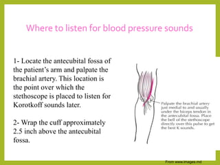 Where to listen for blood pressure sounds
From www.images.md
1- Locate the antecubital fossa of
the patient’s arm and palpate the
brachial artery. This location is
the point over which the
stethoscope is placed to listen for
Korotkoff sounds later.
2- Wrap the cuff approximately
2.5 inch above the antecubital
fossa.
 