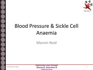 Blood Pressure & Sickle Cell
                   Anaemia
                    Marvin Reid




                   Improving Lives through
Prof Marvin Reid    Research, Education &    1
 