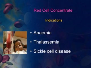 Red Cell Concentrate 
Indications 
• Anaemia 
• Thalassemia 
• Sickle cell disease 
 