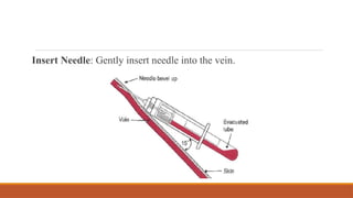 Insert Needle: Gently insert needle into the vein.
 