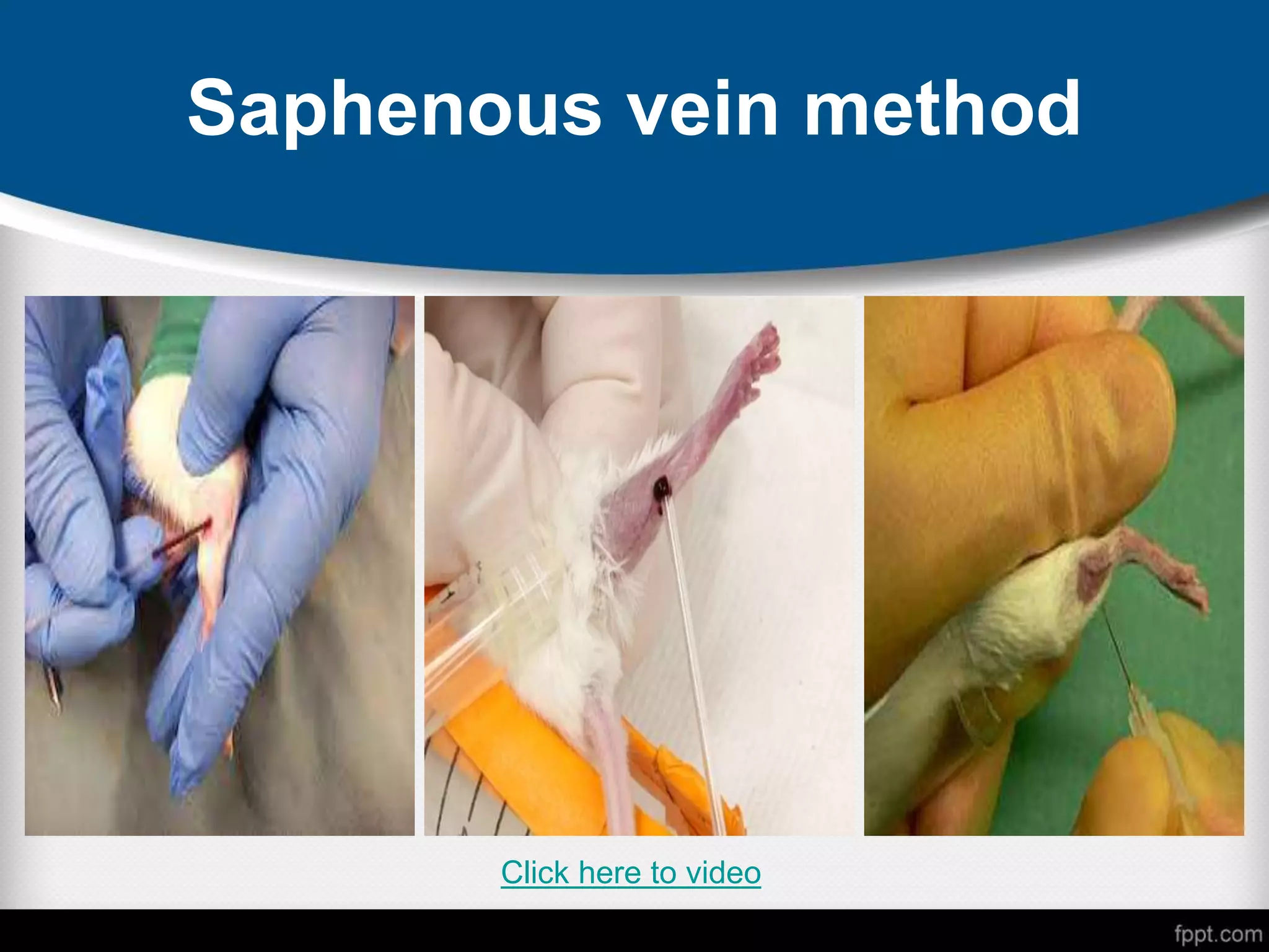 Saphenous vein method
Click here to video
 