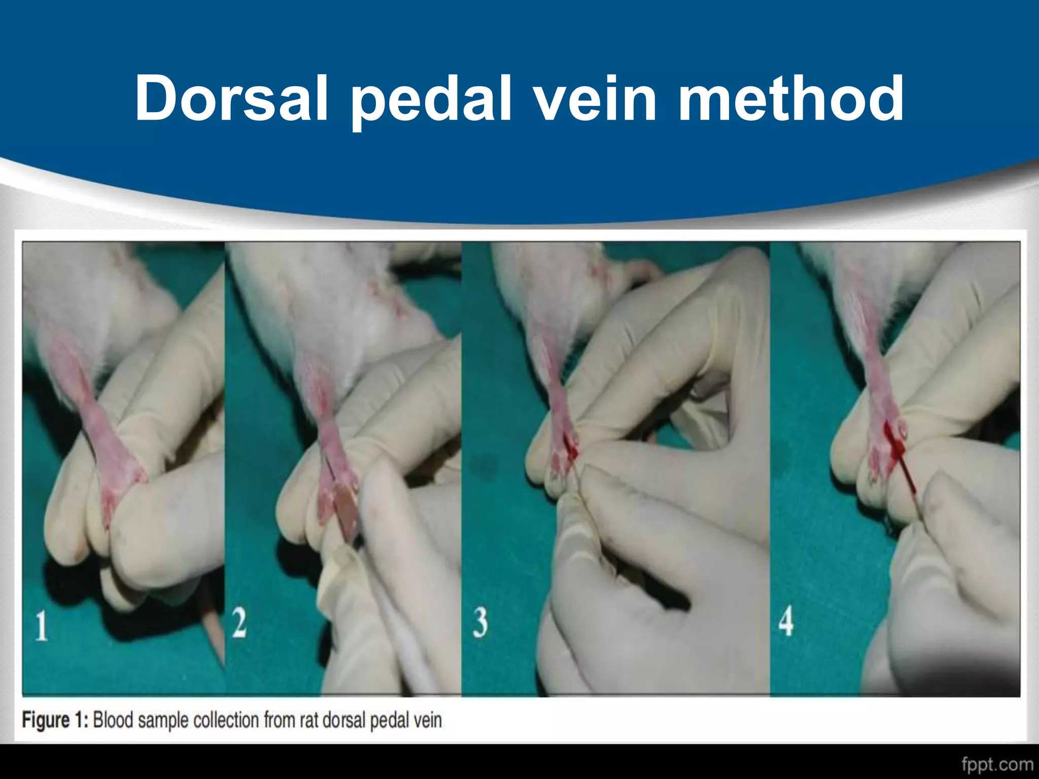 Dorsal pedal vein method
 