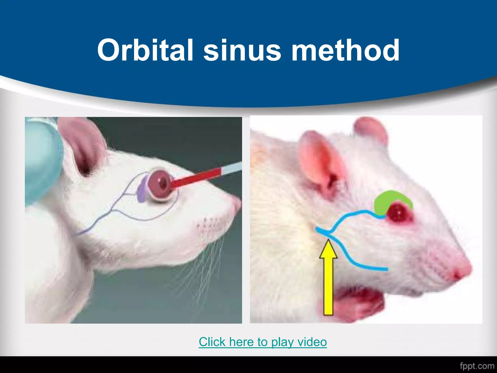 Orbital sinus method
Click here to play video
 