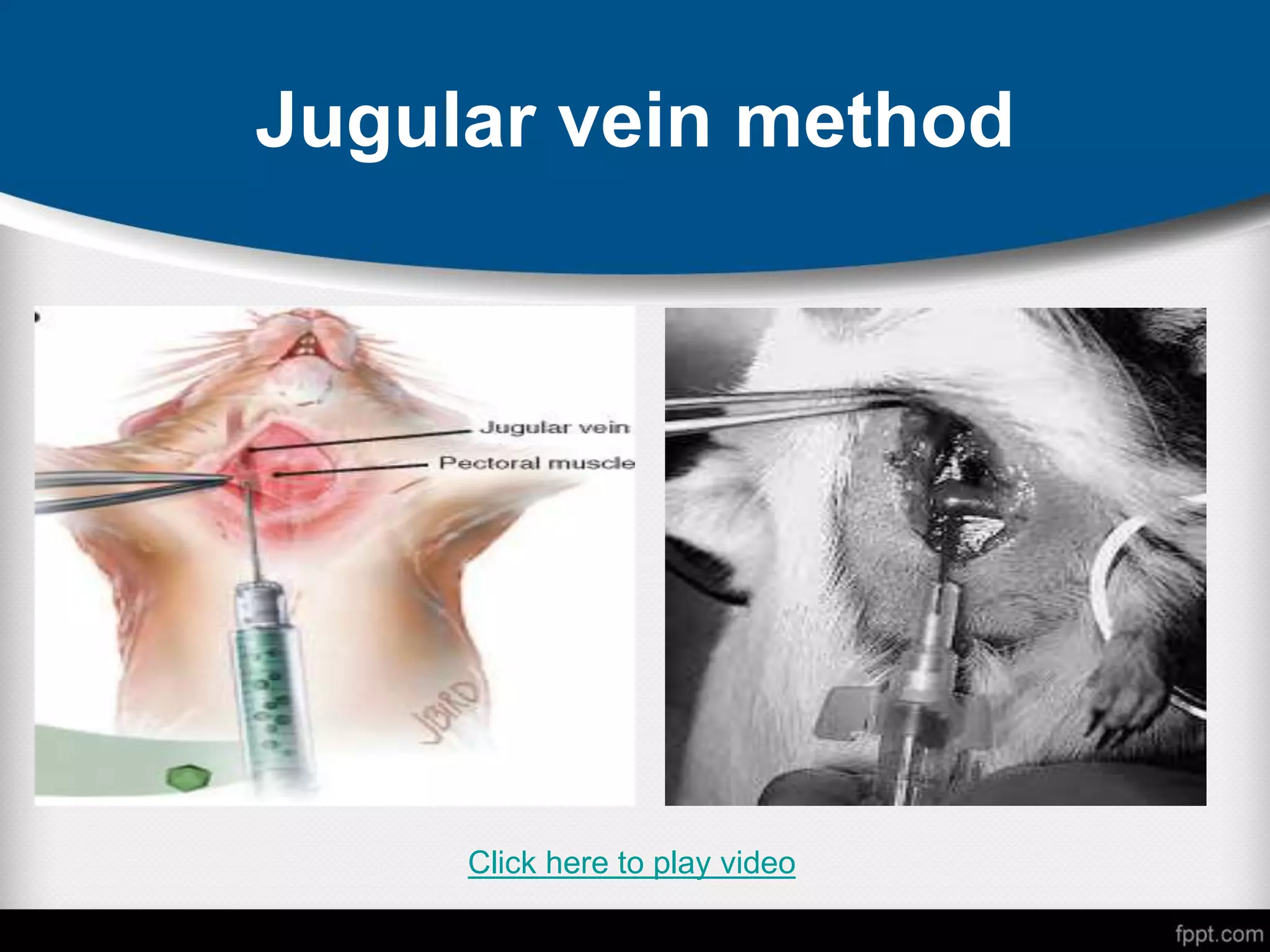 Jugular vein method
Click here to play video
 