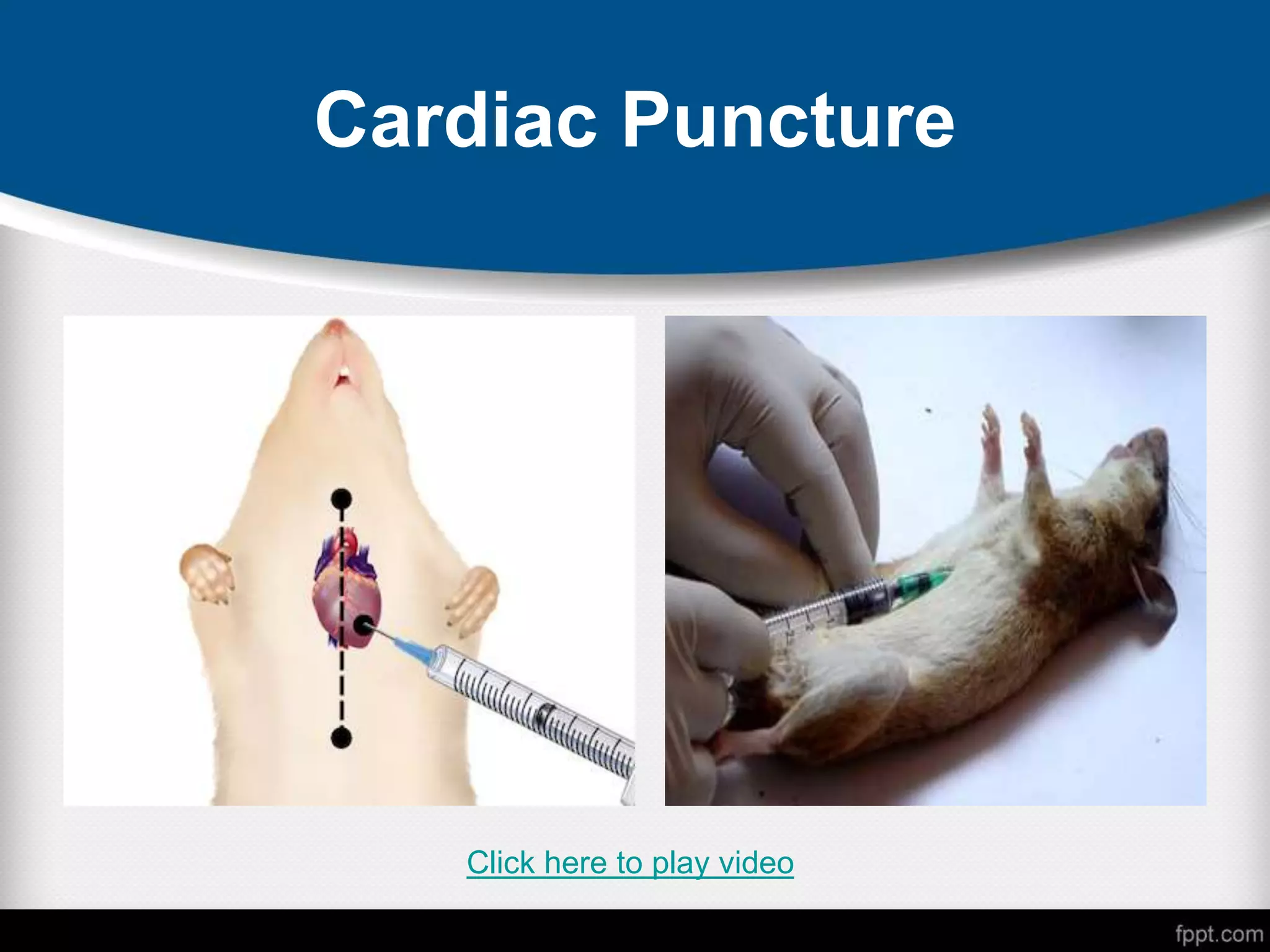 Cardiac Puncture
Click here to play video
 