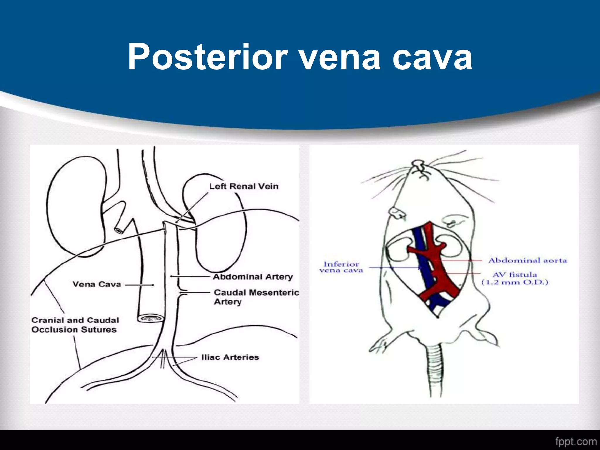 Posterior vena cava
 