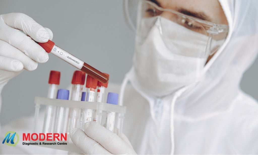 Blood Sample Test Home Collection in Kolkata PPT