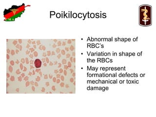 Spikey Rbc Blood smear | PPT