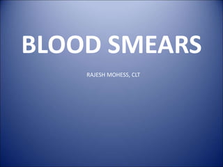 BLOOD SMEARS 
RAJESH MOHESS, CLT 
 