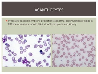 Blood smear evaluation | PPT