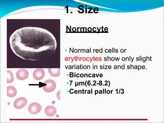 Normocyte
• Normal red cells or
erythrocytes show only slight
variation in size and shape.
•Biconcave
•7 µm(6.2-8.2)
•Central pallor 1/3
1. Size
 