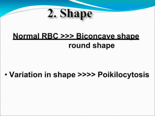 Normal RBC >>> Biconcave shape
round shape
• Variation in shape >>>> Poikilocytosis
 