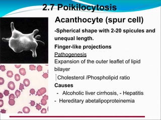 Acanthocyte (spur cell)
-Spherical shape with 2-20 spicules and
unequal length.
Finger-like projections
Pathogenesis
Expansion of the outer leaflet of lipid
bilayer
Cholesterol /Phospholipid ratio
Causes
- Alcoholic liver cirrhosis, - Hepatitis
- Hereditary abetalipoproteinemia
2.7 Poikilocytosis
 