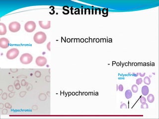 Normochromia
Hypochromia
3. Staining
Polyochrom
asia
- Normochromia
- Hypochromia
- Polychromasia
 