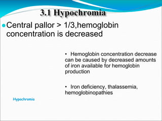 Hypochromia
●Central pallor > 1/3,hemoglobin
concentration is decreased
• Hemoglobin concentration decrease
can be caused by decreased amounts
of iron available for hemoglobin
production
• Iron deficiency, thalassemia,
hemoglobinopathies
 