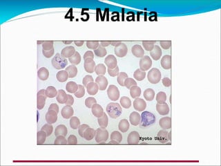 4.5 Malaria
 