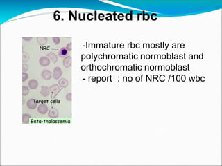 6. Nucleated rbc
-Immature rbc mostly are
polychromatic normoblast and
orthochromatic normoblast
- report : no of NRC /100 wbc
 