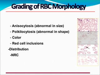 - Anisocytosis (abnormal in size)
- Poikilocytosis (abnormal in shape)
- Color
- Red cell inclusions
-Distribution
-NRC
 