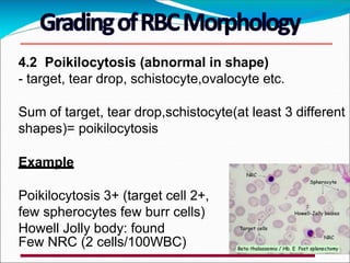 4.2 Poikilocytosis (abnormal in shape)
- target, tear drop, schistocyte,ovalocyte etc.
Sum of target, tear drop,schistocyte(at least 3 different
shapes)= poikilocytosis
Example
Poikilocytosis 3+ (target cell 2+,
few spherocytes few burr cells)
Howell Jolly body: found
Few NRC (2 cells/100WBC)
 