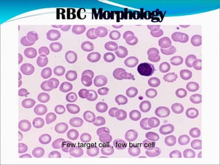 Few target cell , few burr cell
 