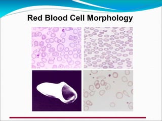 Red Blood Cell Morphology
 