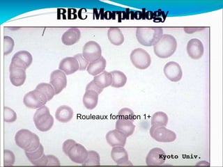Rouleaux formation 1+
 