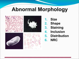 1. Size
2. Shape
3. Staining
4. Inclusion
5. Distribution
6. NRC
Abnormal Morphology
 
