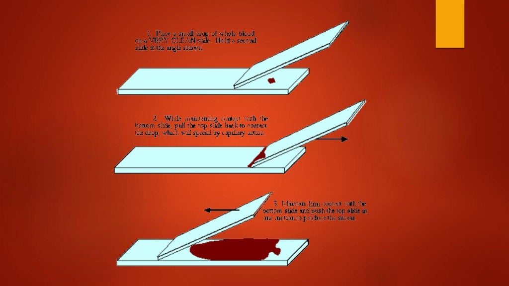 Blood smear preparation, fixation, staining. Veterinary Clinical Exam…