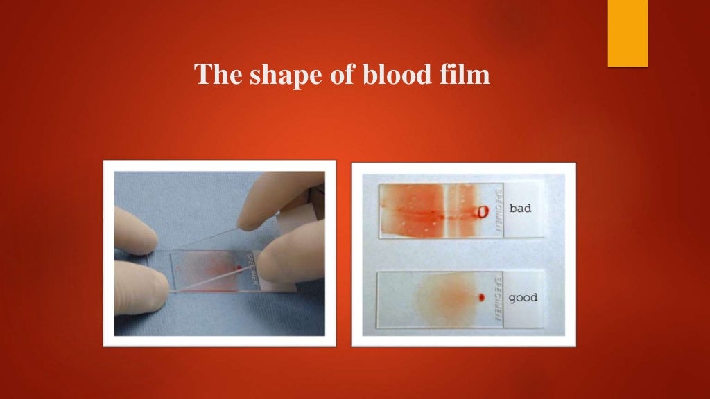 Blood smear preparation, fixation, staining. Veterinary Clinical Exam…