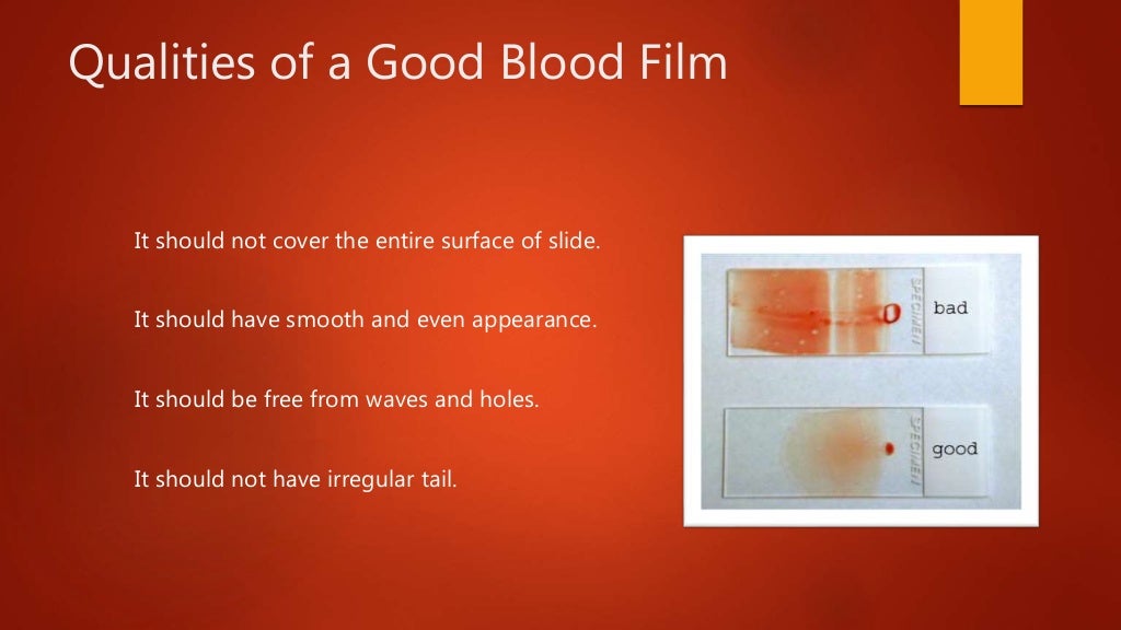 Blood smear preparation, fixation, staining. Veterinary Clinical Exam…