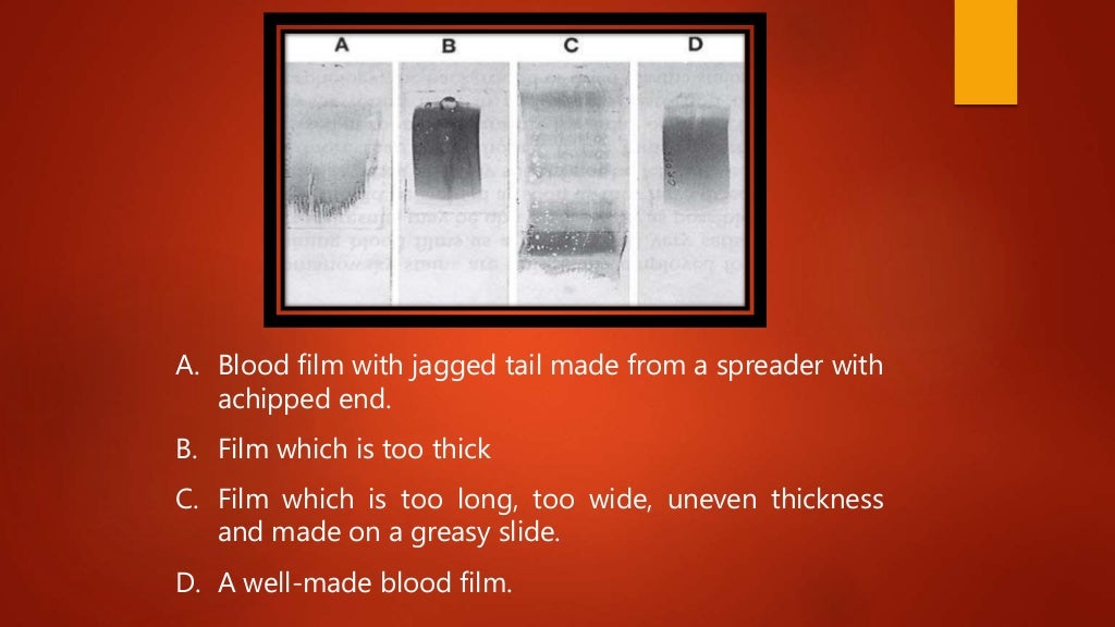 Blood smear preparation, fixation, staining. Veterinary Clinical Exam…