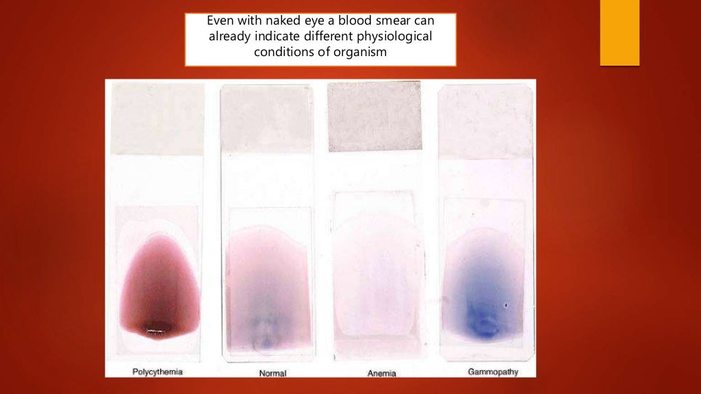 Blood smear preparation, fixation, staining. Veterinary Clinical Exam…