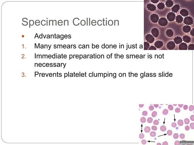 Blood_Smear_Prep__eaf7622f.pptx | Blood Disorders | Diseases and Conditions