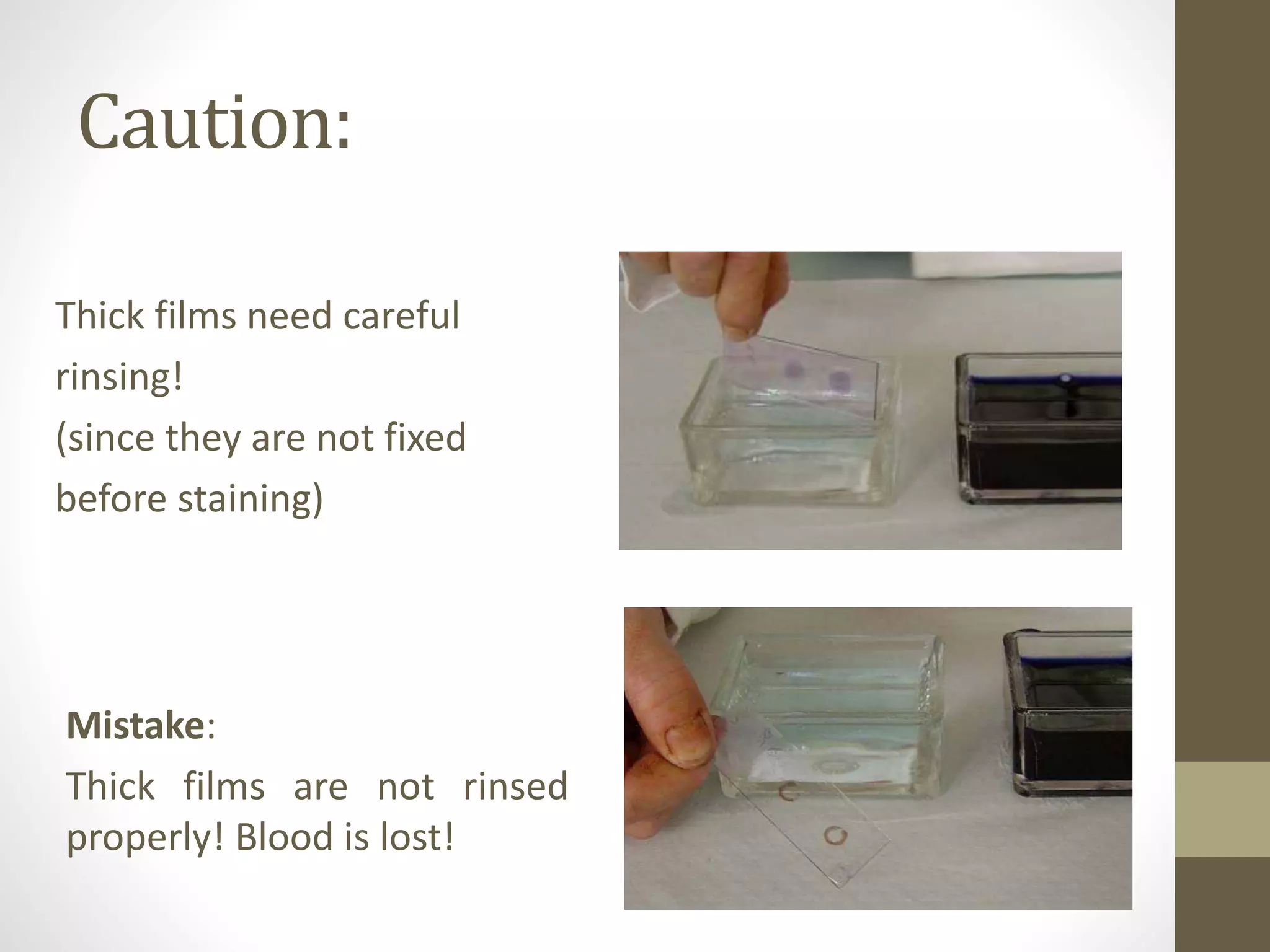 Blood smear staining | PPTX