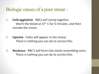 Biologic causes of a poor smear :
1. Cold agglutinin - RBCs will clump together.
Warm the blood at 37° C for 5 minutes, and then
remake the smear.
2. Lipemia - holes will appear in the smear.
There is nothing you can do to correct this.
3. Rouleaux - RBC’s will form into stacks resembling coins.
There is nothing you can do to correct this.
 